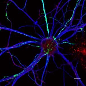 picture of neurons