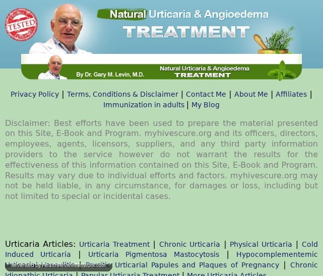 Full Urticaria Cure Review